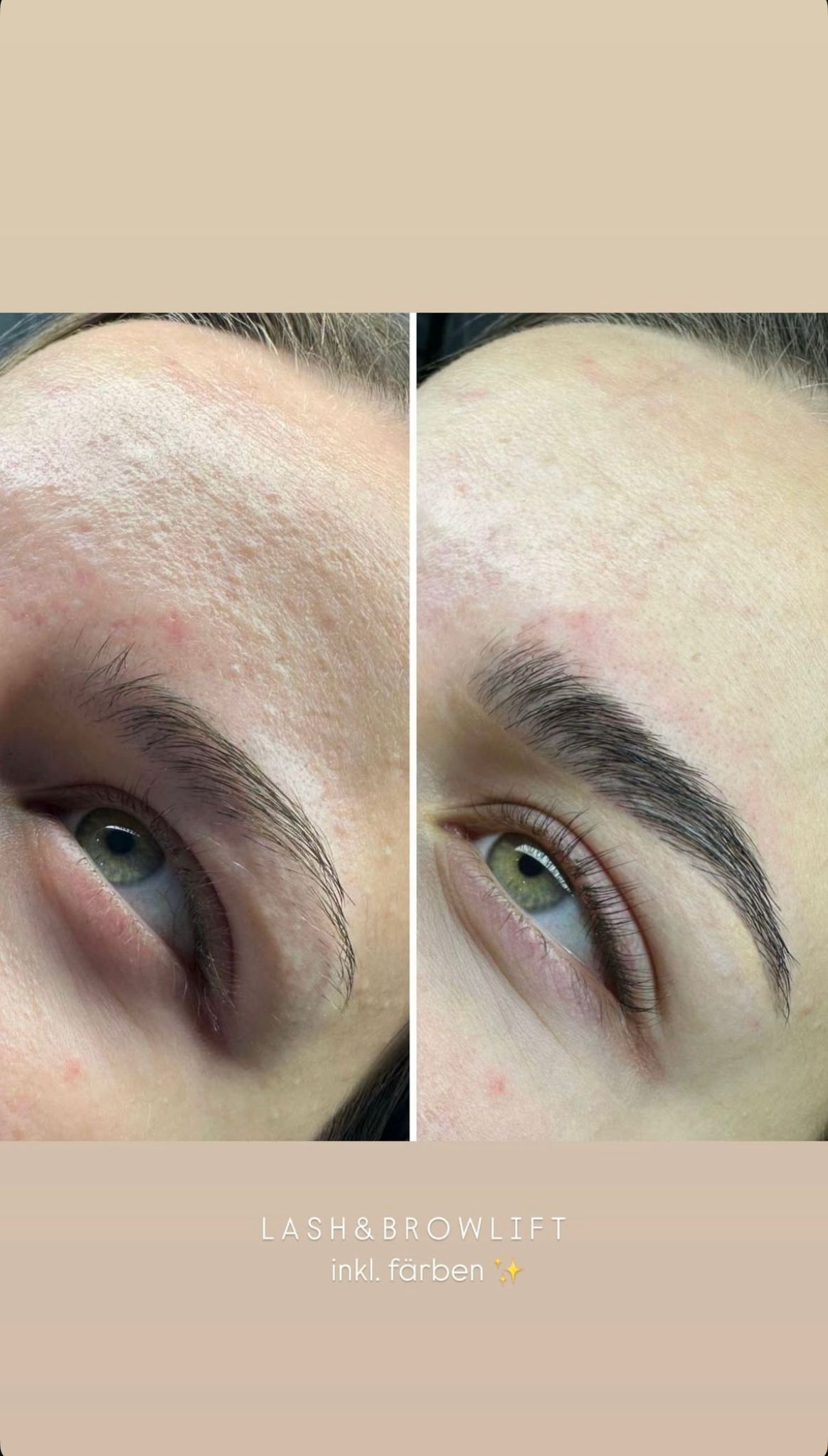 Lash & Browlift Vorher-Nachher